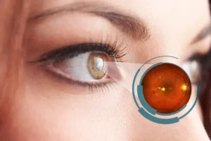Imagem ilustrativa sobre saúde ocular